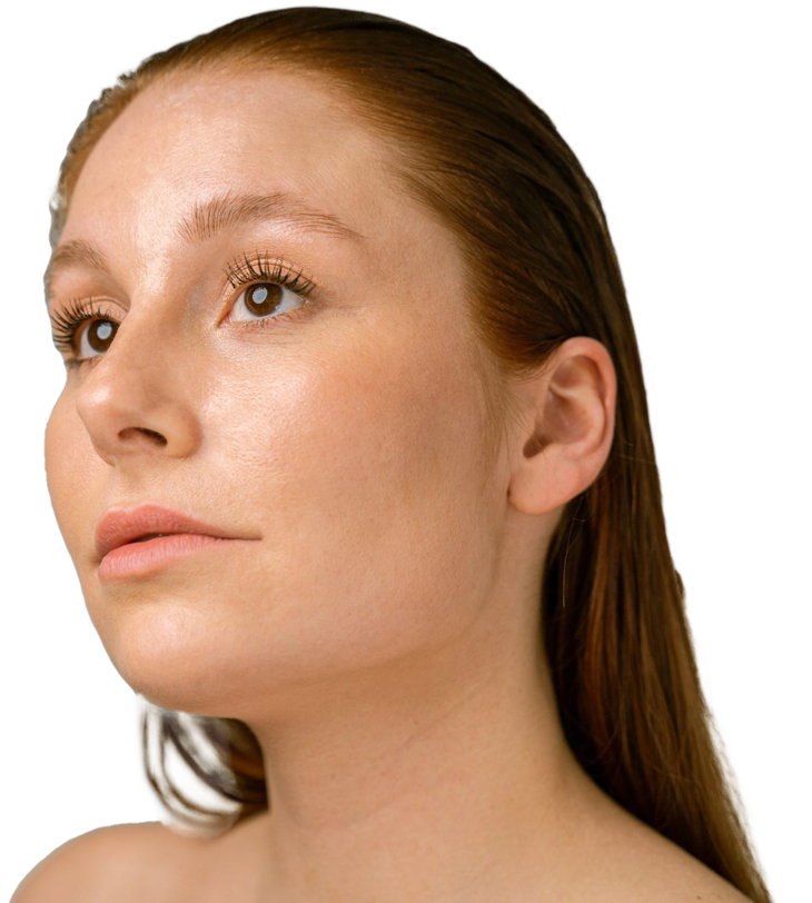 Botox Kraaienpootjes Amsterdam 2 scaled left 1