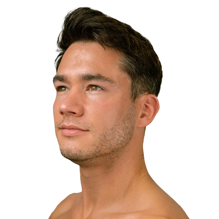 Profhilo huidverbetering Amsterdam scaled 1